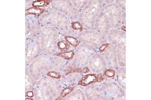 Immunohistochemistry of paraffin-embedded rat kidney using UGT2B15 antibody (ABIN7271194) at dilution of 1:100 (40x lens). (UGT2B15 抗体  (AA 60-190))