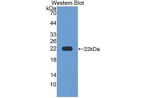 Detection of Recombinant MFAP2, Human using Polyclonal Antibody to Microfibrillar Associated Protein 2 (MFAP2) (MFAP2 抗体  (AA 6-162))