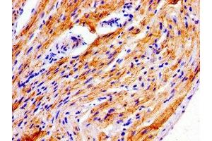 Immunohistochemistry of paraffin-embedded human heart tissue using ABIN7165855 at dilution of 1:100 (NDRG4 抗体  (AA 210-331))