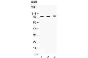 Western blot testing of 1) rat testis, 2) mouse testis and 3) MCF7 lysate with ADAM2 antibody at 0. (ADAM2 抗体  (AA 231-274))