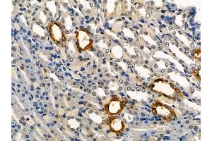 AQP2 Mouse Monoclonal Antibody at 1/100 staining rat kidney tissue by IHC-P. (AQP2 抗体)