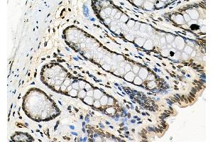ABIN6260852 and ABIN6277771 at 1/100 staining Rat stomach tissue by IHC-P.