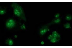 Anti-CDCP1 mouse monoclonal antibody (ABIN2454046) immunofluorescent staining of COS7 cells transiently transfected by pCMV6-ENTRY CDCP1 (RC220633). (CDCP1 抗体)