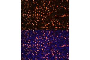 Immunofluorescence (IF) image for anti-S100 Calcium Binding Protein A12 (S100A12) (AA 1-92) antibody (ABIN6147336)