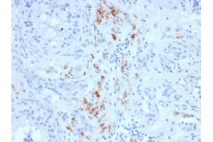 Immunohistochemistry (IHC) image for anti-Steroidogenic Acute Regulatory Protein (STAR) (AA 39-108) antibody (ABIN6940666)