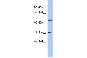 WB Suggested Anti-DBT Antibody Titration: 0. (DBT 抗体  (N-Term))