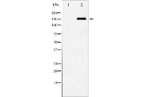 Western blot analysis of ASK1 phosphorylation expression in TNF-α treated MDA-MB-435 whole cell lysates,The lane on the left is treated with the antigen-specific peptide. (ASK1 抗体  (pSer83))