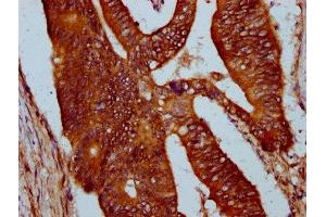 Immunohistochemistry (IHC) image for anti-Signal-Regulatory Protein beta 1 (SIRPB1) (AA 30-206), (Isoform 3) antibody (ABIN7169703)