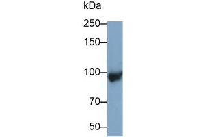 Detection of C4B in Mouse Placenta lysate using Polyclonal Antibody to Complement C4-B (C4B)