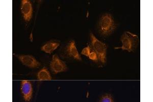 Immunofluorescence analysis of U-2 OS cells using RPL32 Polyclonal Antibody at dilution of 1:100 (40x lens). (RPL32 抗体)