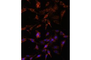 Immunofluorescence analysis of C6 cells using TBCC antibody (ABIN7271029) at dilution of 1:100. (TBCC 抗体  (AA 1-346))