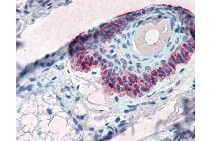 Anti-KRT15 / Cytokeratin 15 antibody IHC of human skin, hair follicle.