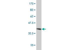 Western Blot detection against Immunogen (37. (NMNAT3 抗体  (AA 116-215))