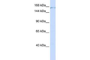 WB Suggested Anti-PDS5A Antibody Titration:  0. (PDS5A 抗体  (C-Term))