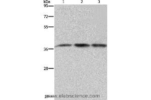 Western blot analysis of 293T and LoVo cell, human brain malignant glioma tissue, using CAB39 Polyclonal Antibody at dilution of 1:450 (CAB39 抗体)