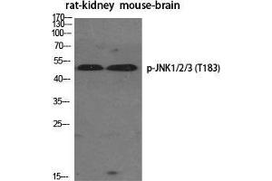 Western Blot (WB) analysis of specific cells using Phospho-JNK1/2/3 (T183) Polyclonal Antibody. (JNK 抗体  (pThr183))