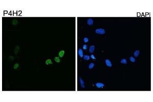 Diluted 1:10,000 on rhabdomyosarcoma cell line RD transfected with pCS2-DUX4. (DUX4 抗体  (C-Term))