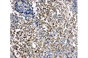 Anti-TIM 1 antibody, IHC(P) IHC(P): Human Tonsil Tissue (HAVCR1 抗体  (C-Term))