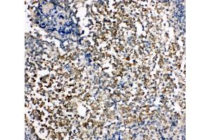 Anti-TIM 1 antibody, IHC(P) IHC(P): Human Tonsil Tissue