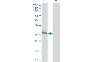 Western Blot analysis of CLIC1 expression in transfected 293T cell line by CLIC1 monoclonal antibody (M02), clone 3F9.