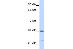 NUSAP1 antibody used at 1 ug/ml to detect target protein. (NUSAP1 抗体  (C-Term))