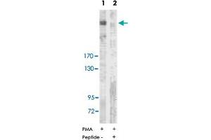 Western blot analysis of extracts from NIH/3T3 cells treated with PMA (125 ng/ml, 15 min), using ACACA polyclonal antibody . (Acetyl-CoA Carboxylase alpha 抗体  (Ser80))