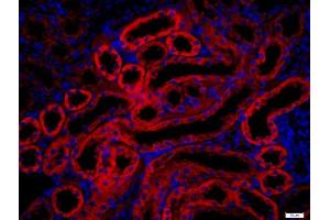 Paraformaldehyde-fixed, paraffin embedded rat kidney, Antigen retrieval by boiling in sodium citrate buffer (pH6. (PAK1 抗体  (AA 201-300))