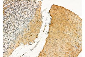 ABIN6258450 and ABIN6275840 at 1/100 staining Rat stomach tissue by IHC-P. (DDR1 抗体  (Internal Region))