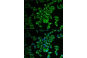 Immunofluorescence analysis of A549 cells using FXN antibody. (Frataxin 抗体  (AA 42-210))