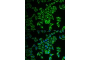 Immunofluorescence analysis of A549 cells using FXN antibody. (Frataxin 抗体  (AA 42-210))