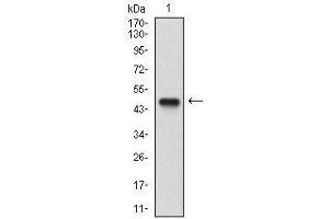 Fig. (Nibrin 抗体  (AA 467-615))