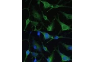 Immunofluorescence analysis of U-251 MG cells using F antibody (ABIN6129530, ABIN6140428, ABIN6140430 and ABIN6215290) at dilution of 1:100. (FABP7 抗体  (AA 1-132))