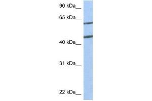 Netrin 4 antibody used at 1 ug/ml to detect target protein. (Netrin 4 抗体  (N-Term))