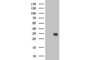 Western Blotting (WB) image for anti-Translocase of Outer Mitochondrial Membrane 34 (TOMM34) antibody (ABIN1501465) (TOMM34 抗体)