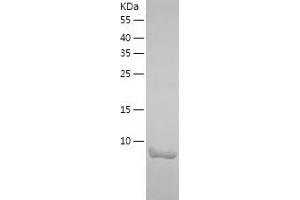 KAT2A Protein (AA 727-837) (His tag)