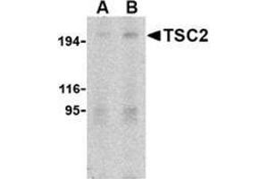 Western blot analysis of TSC2 in L1210 cell lysate with this product at (A) 2 and (B) 4 μg/ml. (Tuberin 抗体  (N-Term))