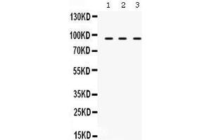 Western Blotting (WB) image for anti-Transporter 1, ATP-Binding Cassette, Sub-Family B (MDR/TAP) (TAP1) (AA 438-471), (Middle Region) antibody (ABIN3043943) (TAP1 抗体  (Middle Region))