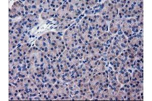 Immunohistochemical staining of paraffin-embedded Human pancreas tissue using anti-KATNAL1 mouse monoclonal antibody. (KATNAL1 抗体)