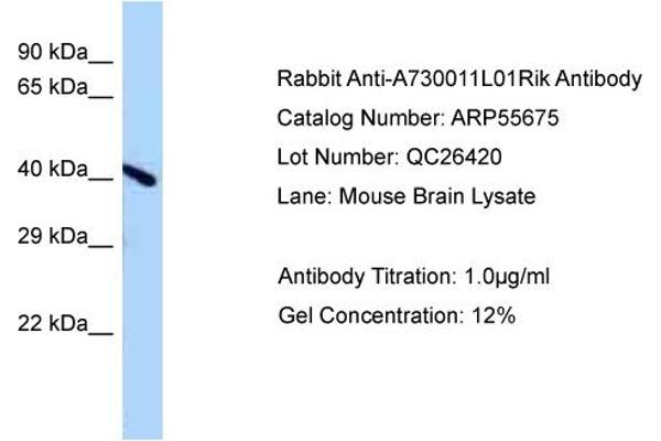 Endonuclease V 抗体  (Middle Region)