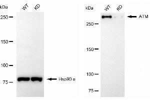 Western blotting analysis using ATM antibody (ABIN7797667). (Recombinant ATM 抗体)
