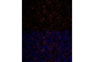 Immunofluorescence (IF) image for anti-Aquaporin 3 (Gill Blood Group) (AQP3) (AA 178-292) antibody (ABIN3016812)
