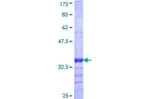 MMP28 Protein (AA 441-520) (GST tag)