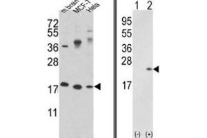 Western Blotting (WB) image for anti-Cofilin 1 (CFL1) antibody (ABIN3001704) (Cofilin 抗体)