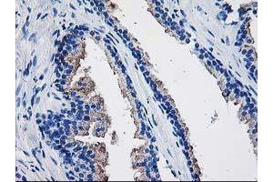 Immunohistochemical staining of paraffin-embedded Human prostate tissue using anti-TBC1D21 mouse monoclonal antibody. (TBC1D21 抗体)