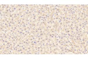 Detection of ITIH4 in Rat Liver Tissue using Polyclonal Antibody to Inter Alpha-Globulin Inhibitor H4 (ITIH4) (ITIH4 抗体  (AA 478-722))