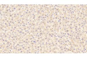 Detection of ITIH4 in Rat Liver Tissue using Polyclonal Antibody to Inter Alpha-Globulin Inhibitor H4 (ITIH4) (ITIH4 抗体  (AA 478-722))
