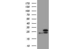 Image no. 1 for anti-Ubiquitin-Conjugating Enzyme E2E 3 (UBE2E3) antibody (ABIN1501626) (UBE2E3 抗体)