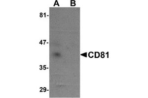 Western Blotting (WB) image for anti-CD81 (CD81) (N-Term) antibody (ABIN1031309) (CD81 抗体  (N-Term))