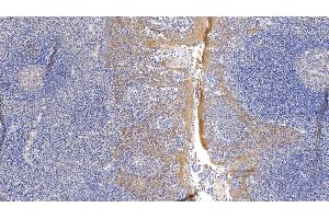 Detection of CK17 in Human Tonsil Tissue using Monoclonal Antibody to Cytokeratin 17 (CK17) (KRT17 抗体  (AA 252-393))