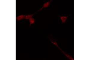 ABIN6274368 staining HeLa cells by IF/ICC. (TAF1A 抗体  (Internal Region))